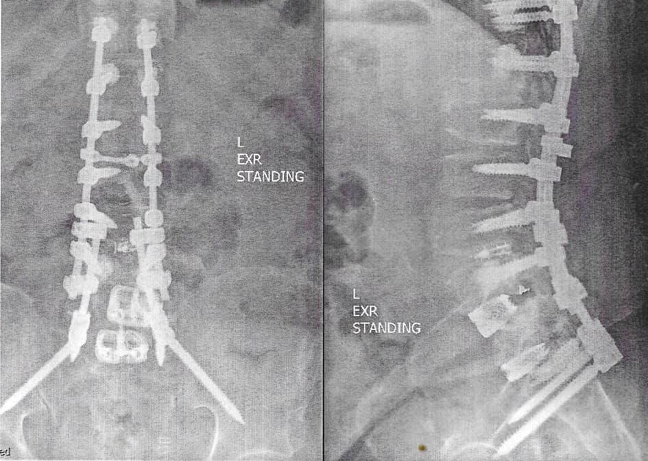Align Spine Center - Photo 2
