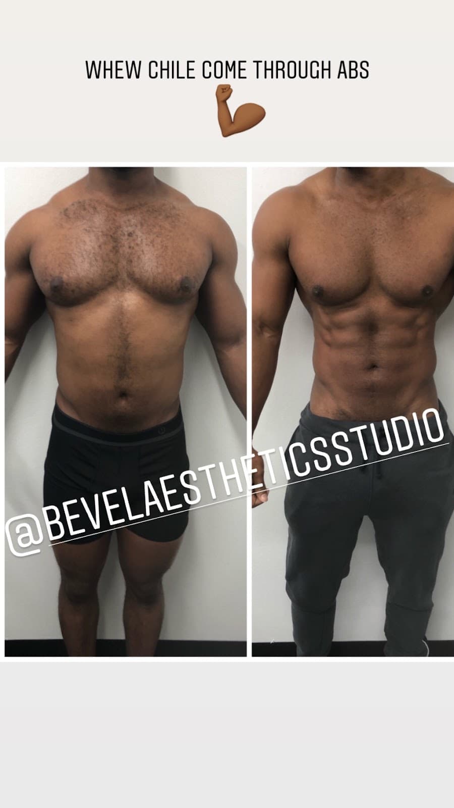 Bevel Aesthetics Studio & Wellness - Photo 2
